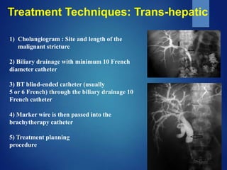 Take home message
 Hepato-biliary brachytherapy is a safe, effective and
applicable technique
 The indications have expa...