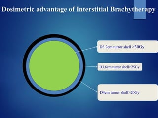 Hepatobiliary brachytherapy