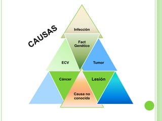 Infección 
ECV 
Fact 
Genético 
Tumor 
Cáncer 
Causa no 
conocida 
Lesión 
 