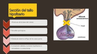 •Fracturas de la base del cráneo
• Secuelas quirúrgicas.
• Obstáculo externo al flujo de los vasos porta
• Compresión debida a tumores hipofisarios o
extraselares o a aneurismas
 