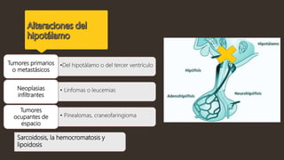 •Del hipotálamo o del tercer ventrículoTumores primarios
o metastásicos
• Linfomas o leucemiasNeoplasias
infiltrantes
• Pinealomas, craneofaringioma
Tumores
ocupantes de
espacio
Sarcoidosis, la hemocromatosis y
lipoidosis
 
