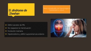  Déficit secretor de PRL
 No reaparece la menstruación
 Involución mamaria
 Hipotiroidismo y déficit suprarrenal secundarios
Parto complicado con hemorragia e
hipotensión o shock
 