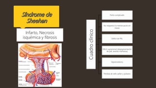 Infarto, Necrosis
isquémica y fibrosis
Cuadroclínico
Parto complicado
No reaparece la menstruación en
meses
Deficit de PRL
Dificit suprarrenal (despigmentación
de piel, areolas mamarias)
Hipotiroidismo
Perdida de vello axillar y pubiano
 