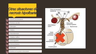 1
• Arteritis de la temporal
2
• Diversas vasculitis
3
• Meningitis
4
• Malaria
5
• Hipovitaminosis
6
• Diabetes mellitus
7
• Anticoagulante
8
• Hemocromatosis
9
• Eclampsia
10
•Cambios en la presión intracraneal.
 