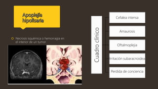  Necrosis isquémica o hemorragia en
el interior de un tumor
Cuadroclínico
Cefalea intensa
Amaurosis
Oftalmoplejia
Irritación subaracnoidea
Perdida de conciencia
 