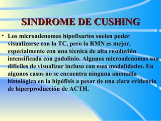 SINDROME DE CUSHING Los microadenomas hipofisarios suelen poder visualizarse con la TC, pero la RMN es mejor, especialmente con una técnica de alta resolución intensificada con gadolinio. Algunos microadenomas son difíciles de visualizar incluso con esas modalidades. En algunos casos no se encuentra ninguna anomalía histológica en la hipófisis a pesar de una clara evidencia de hiperproducción de ACTH. 