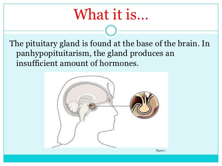 Panhypopituitarism