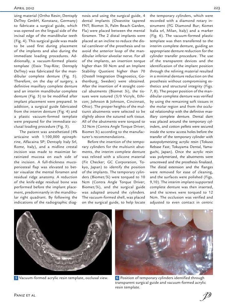 A technique for immediate occlusal implant loading of a completely