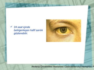Akdeniz Üniversitesi Hastanesi Gastroenteroloji Hemşiresi P
 24 saat içinde
belirgenleşen hafif sarılık
gözlenebilir.
 
