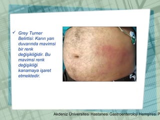 Akdeniz Üniversitesi Hastanesi Gastroenteroloji Hemşiresi P
 Grey Turner
Belirtisi: Karın yan
duvarında mavimsi
bir renk
değişikliğidir. Bu
mavimsi renk
değişikliği
kanamaya işaret
etmektedir.
 