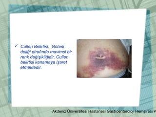 Akdeniz Üniversitesi Hastanesi Gastroenteroloji Hemşiresi P
 Cullen Belirtisi: Göbek
deliği etrafında mavimsi bir
renk değişikliğidir. Cullen
belirtisi kanamaya işaret
etmektedir.
 