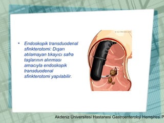 Akdeniz Üniversitesi Hastanesi Gastroenteroloji Hemşiresi P
• Endoskopik transduodenal
sfinkterotomi: Dışarı
atılamayan tıkayıcı safra
taşlarının alınması
amacıyla endoskopik
transduodenal
sfinkterotomi yapılabilir.
 