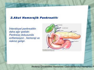 Akdeniz Üniversitesi Hastanesi Gastroenteroloji Hemşiresi P
2.Akut Hemorajik Pankreatit:
İnterstisyel pankreatitin
daha ağır şeklidir.
Pankreas dokusunda
enflamasyon , hemoraji ve
nekroz gelişir.
 
