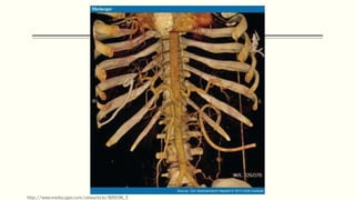 http://www.medscape.com/viewarticle/809196_5
 