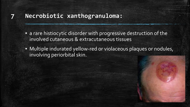 Panniculitis.rooks.dermatology | PPTX | Skin and Dermatology | Diseases ...