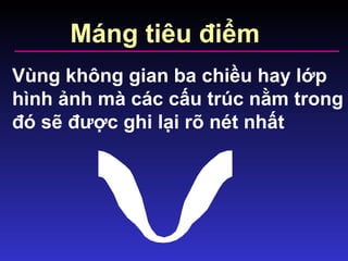 Máng tiêu điểm
Vùng không gian ba chiều hay lớp
hình ảnh mà các cấu trúc nằm trong
đó sẽ được ghi lại rõ nét nhất
 