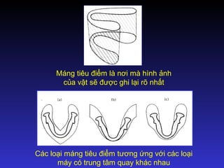 Các loại máng tiêu điểm tương ứng với các loại
máy có trung tâm quay khác nhau
Máng tiêu điểm là nơi mà hình ảnh
của vật sẽ được ghi lại rõ nhất
 