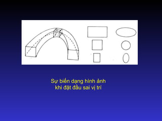 Sự biến dạng hình ảnh
khi đặt đầu sai vị trí
 