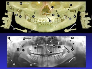 33
255
28
9 12
14
18
17
19
22
13
7
6
39
9
5
25
28
14
33
12
18
17
19
13
22
7
39
6
 