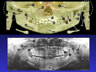 8
20
11
15
116
3
30
44
32 23
2
31
26
38
34
24
8
20
11
15
1
2
3
30
44
32 23
31
38
34
16
24
26
4
 