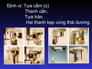Định vị: Tựa cầm (±)
Thanh cắn.
Tựa trán.
Hai thanh kẹp vùng thái dương.
 
