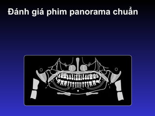 Đánh giá phim panorama chuẩn
 