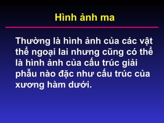 Hình ảnh ma
Thường là hình ảnh của các vật
thể ngoại lai nhưng cũng có thể
là hình ảnh của cấu trúc giải
phẫu nào đặc như cấu trúc của
xương hàm dưới.
 
