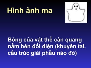 Hình ảnh ma
Bóng của vật thể cản quang
nằm bên đối diện (khuyên tai,
cấu trúc giải phẫu nào đó)
 