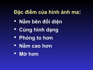 Đặc điểm của hình ảnh ma:
 Nằm bên đối diện
 Cùng hình dạng
 Phóng to hơn
 Nằm cao hơn
 Mờ hơn
 