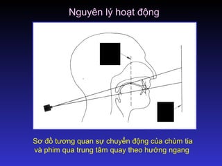Sơ đồ tương quan sự chuyển động của chùm tia
và phim qua trung tâm quay theo hướng ngang
Trung
tâm
quay
Mặt
phẳng
phim
Nguyên lý hoạt động
 