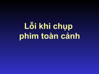 Lỗi khi chụp
phim toàn cảnh
 