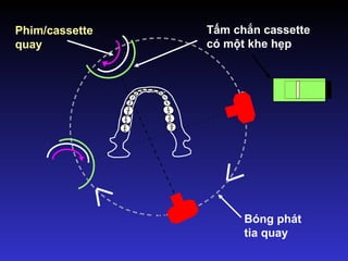 Tấm chắn cassette
có một khe hẹp
Bóng phát
tia quay
Phim/cassette
quay
 