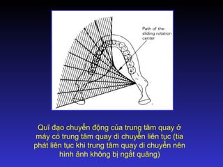 Quĩ đạo chuyển động của trung tâm quay ở
máy có trung tâm quay di chuyển liên tục (tia
phát liên tục khi trung tâm quay di chuyển nên
hình ảnh không bị ngắt quãng)
 