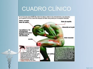 CUADRO CLÍNICO
 