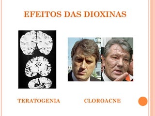 EFEITOS DAS DIOXINAS




TERATOGENIA   CLOROACNE
 