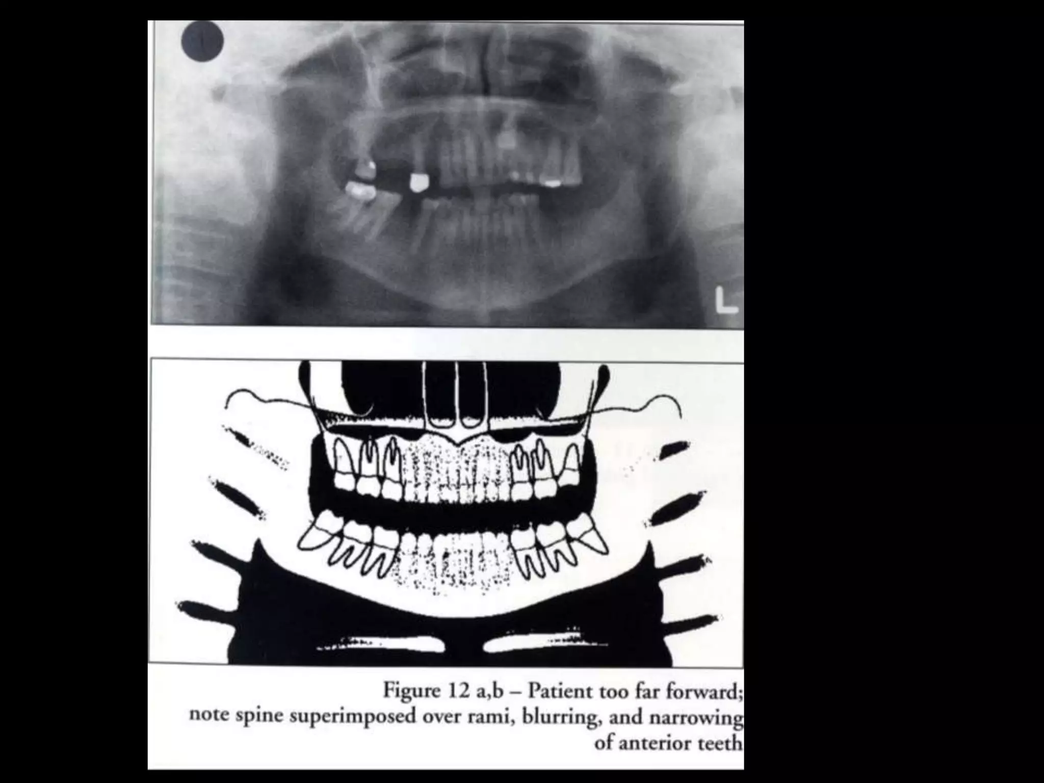 Panoramic-radiography.ppt