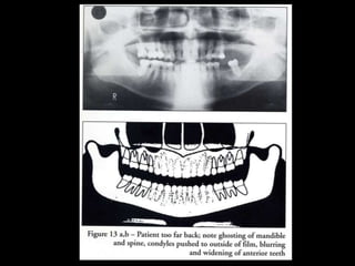 Panoramic-radiography.ppt