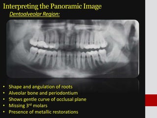 Panoramic imaging | PPTX