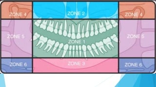 Panoramic radiograph | PPTX