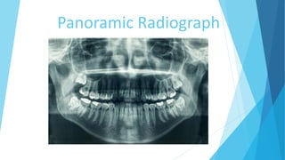 Panoramic Radiograph
 