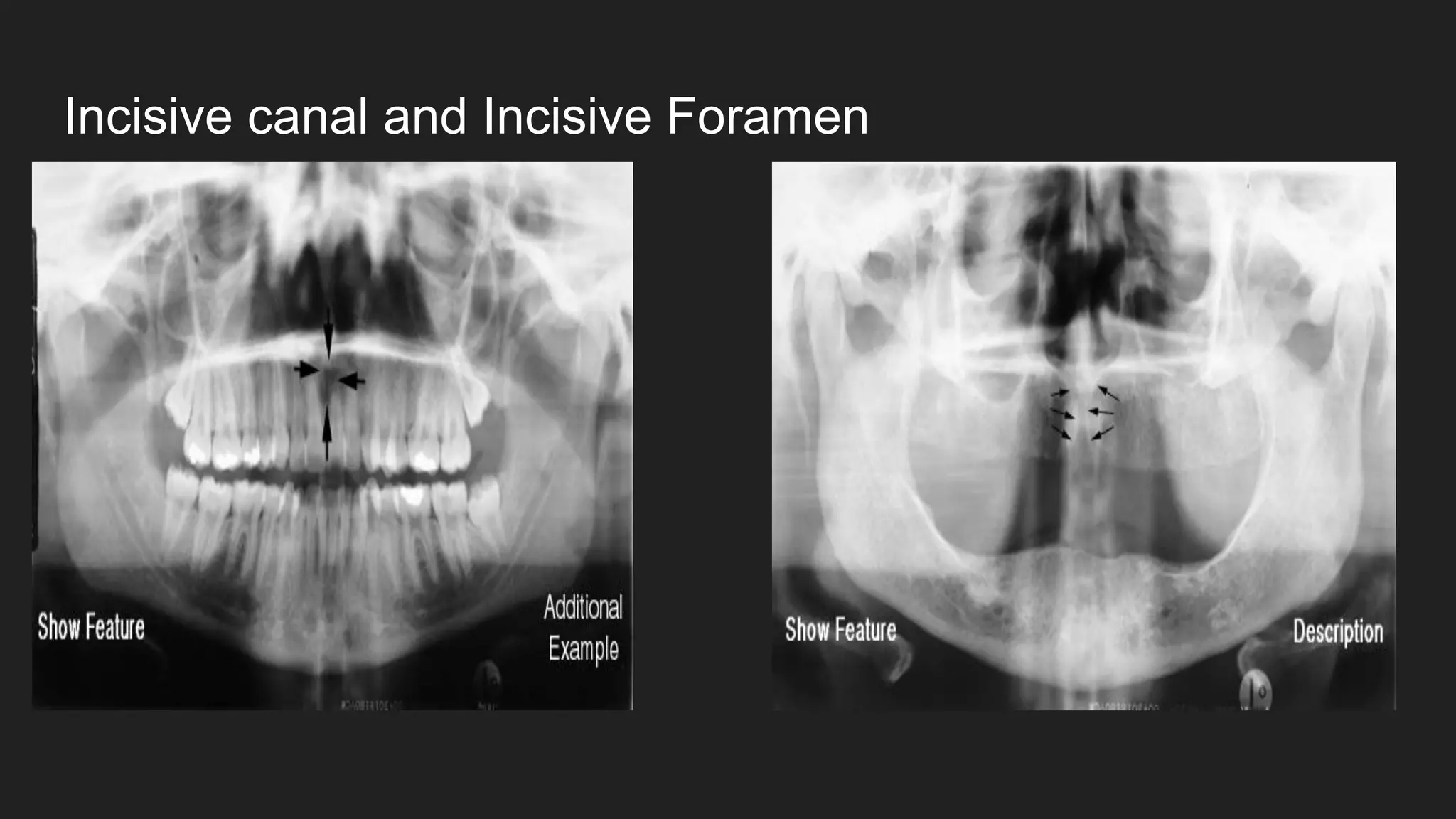 PANORAMIC RADIOGRAPHS .pdf