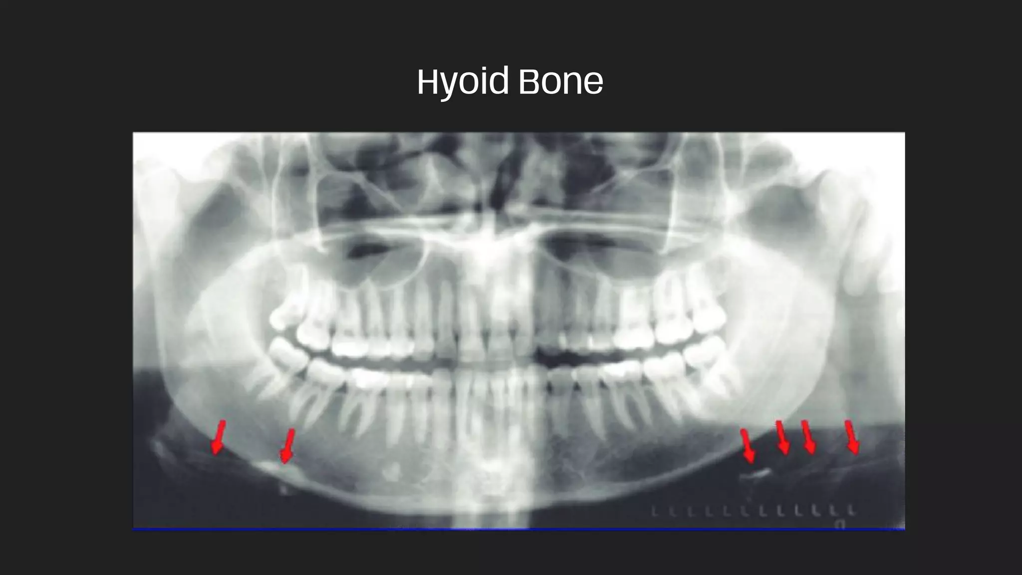 PANORAMIC RADIOGRAPHS .pdf