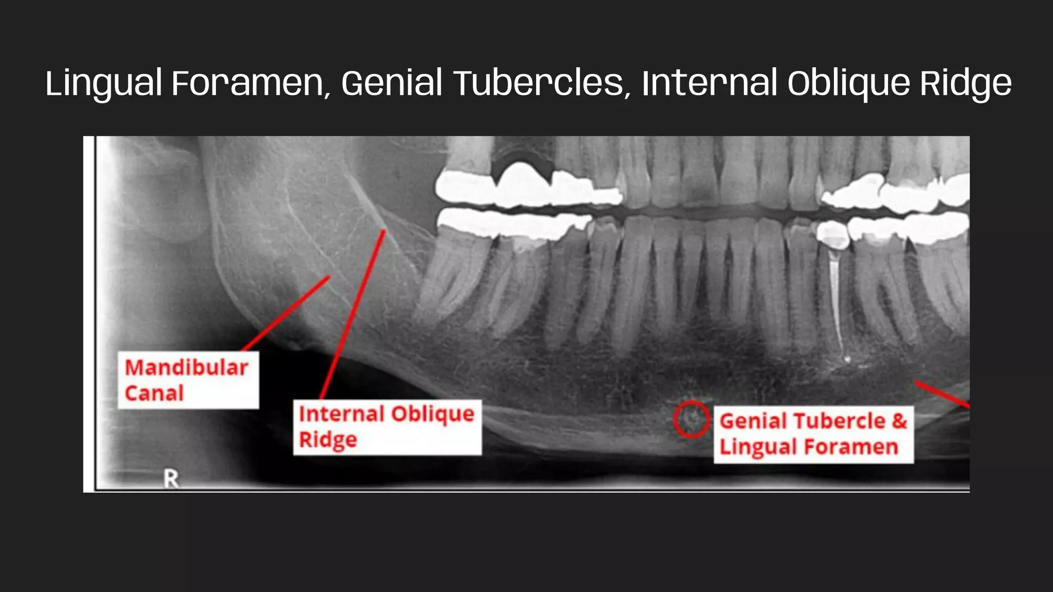 PANORAMIC RADIOGRAPHS pdf PANORAMIC RADIOGRAPHS pdf