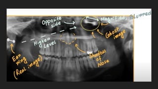 PANORAMIC RADIOGRAPHS .pdf