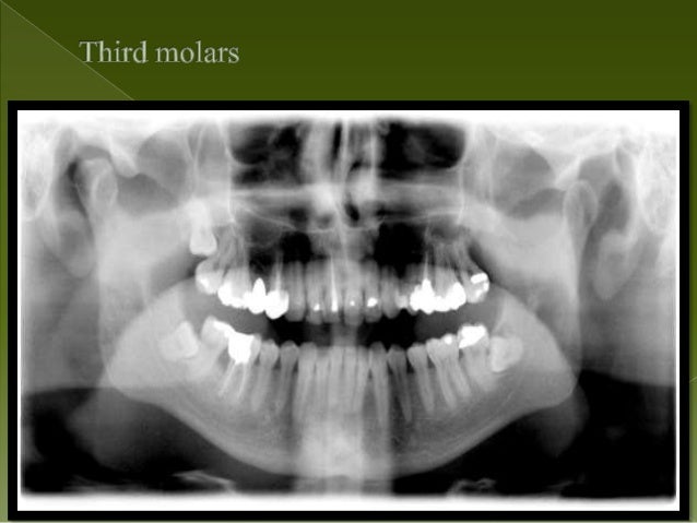 Panoramic radiography