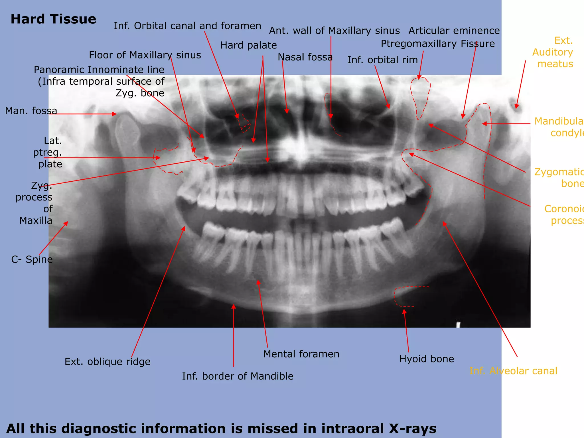 Panoramic radiography | PPTX
