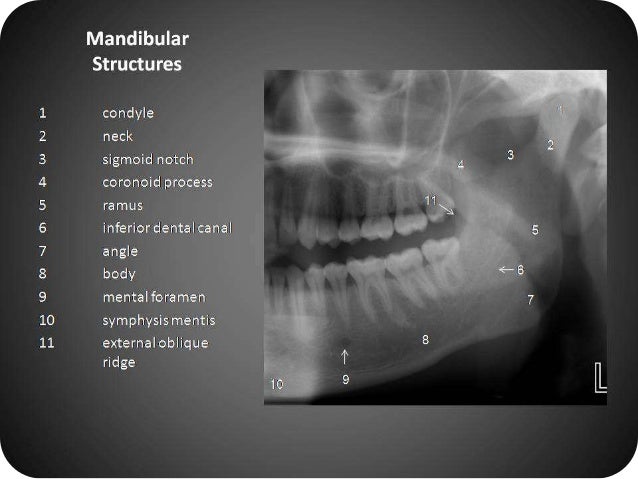 Panoramic radiography