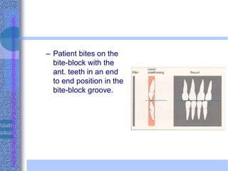 – Patient bites on the
bite-block with the
ant. teeth in an end
to end position in the
bite-block groove.
 