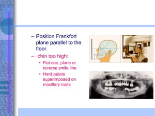 – Position Frankfort
plane parallel to the
floor.
– chin too high:
• Flat occ. plane or
reverse smile line
• Hard palate
superimposed on
maxillary roots
 