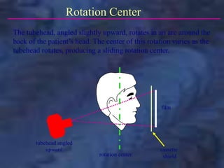 rotation center
film
tubehead angled
upward
Rotation Center
The tubehead, angled slightly upward, rotates in an arc around the
back of the patient’s head. The center of this rotation varies as the
tubehead rotates, producing a sliding rotation center.
cassette
shield
 